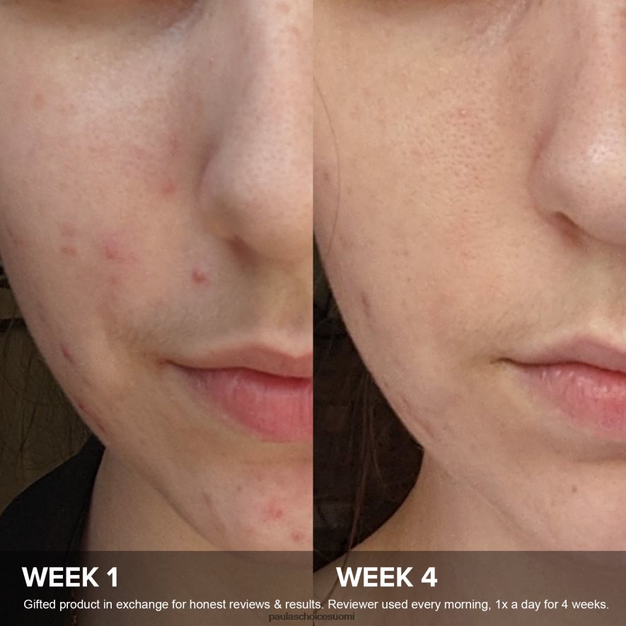 Paula's Choice koko c15 supertehostin 4FL4PT78