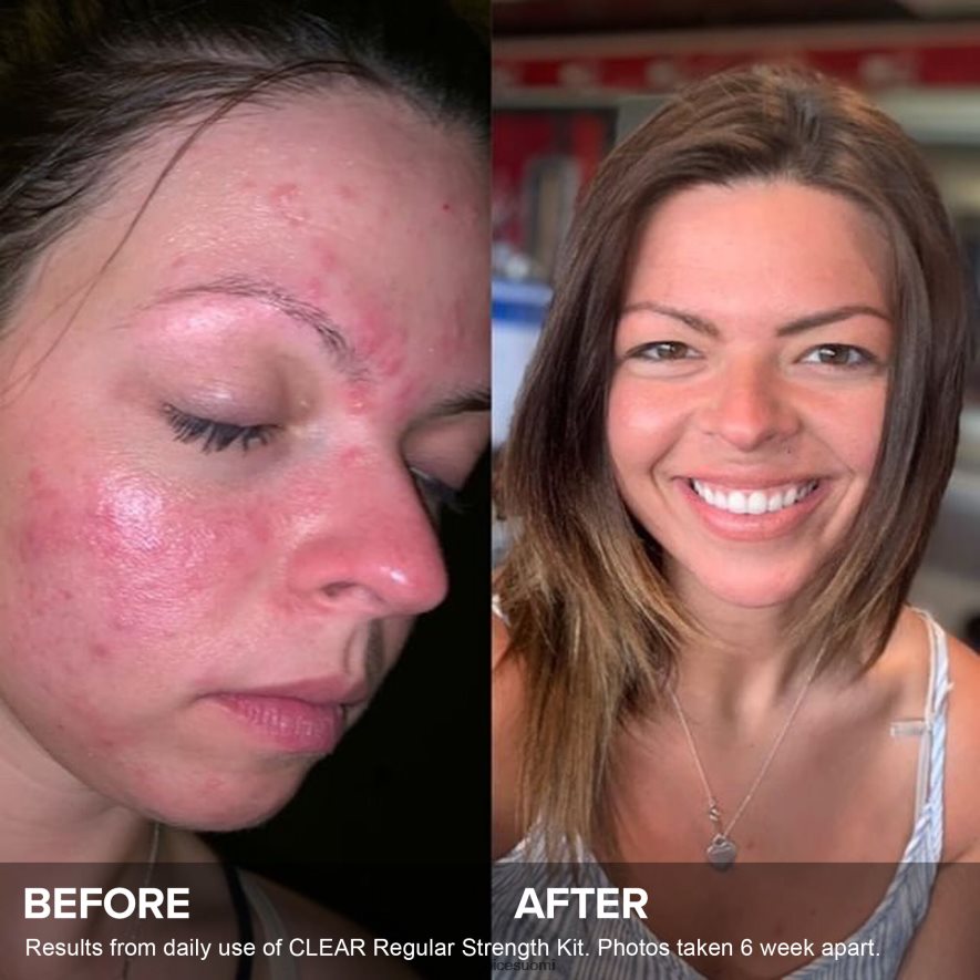 Paula's Choice 3-vaiheinen rutiini lisävoimapakkaus 4FL4PT8